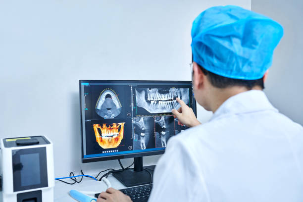 Best Emergency Denture Repair in Buffalo, NY
